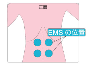 EMSの着ける位置