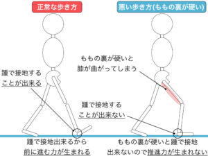 ハムストリング緊張亢進による影響